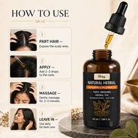 Minyak Herbal Jahe Rosemary Castor OEM untuk Perawatan Kulit Kepala, Serum Nutrisi Akar Rambut untuk Menjaga Rambut Kering dan Menipis