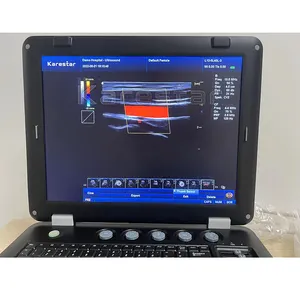 Echografie Draagbare Kleur Doppler Ultrasone Ultrasone Machine Voor Dierlijke Medische Ultrasone Instrumenten