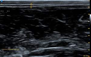 Kit Completo IPX7 Ecografo Android Portatil Para <span class=keywords><strong>Veterinaria</strong></span> Bovina Con Garantía - Product Image 4