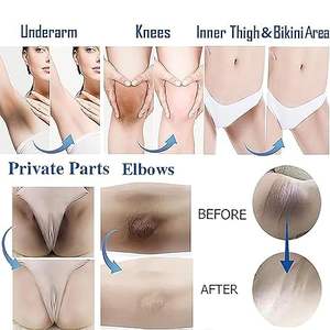 Крем для осветления кожи для темных подмышек, колен, локтей, внутренней части бедра, линии бикини, отбеливающий крем для области подмышек - Product Image 3
