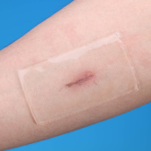 Lámina de silicona para cicatrices, parche médico de silicona en forma de ancla para eliminación de cicatrices en senos, queloides y cesáreas - Product Image 2