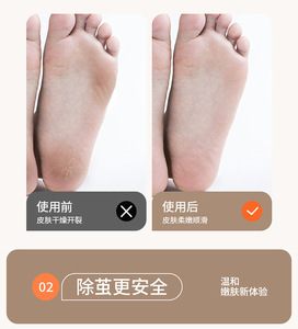 Lime électrique multifonction pour les pieds, élimine les callosités et les peaux mortes, rechargeable pour des pieds magnifiques - Product Image 2
