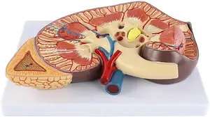 Modelo de riñón de aumento de 3 veces con estructura de anatomía precisa Modelo de riñón agrandado anatómico transparente Textura Digital - Product Image 3