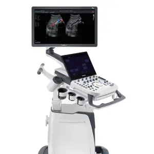 Sonoscape P25 Elite 4D Digital Color Doppler Medical Ultrasound Scanner 3D Ultrasonic System