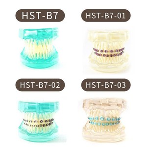Modelo de Ortodoncia Dental Serie HST B6 con Aparatos para Práctica y Enseñanza - Product Image 5