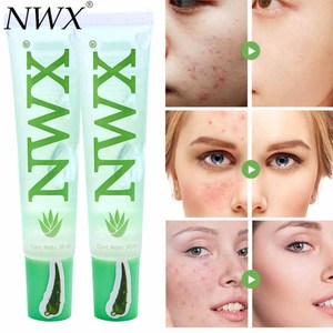 NWX-Gel de <span class=keywords><strong>Aloe</strong></span> Vera calmante, 100% <span class=keywords><strong>hidratante</strong></span>, reparación, alta calidad - Product Image 5