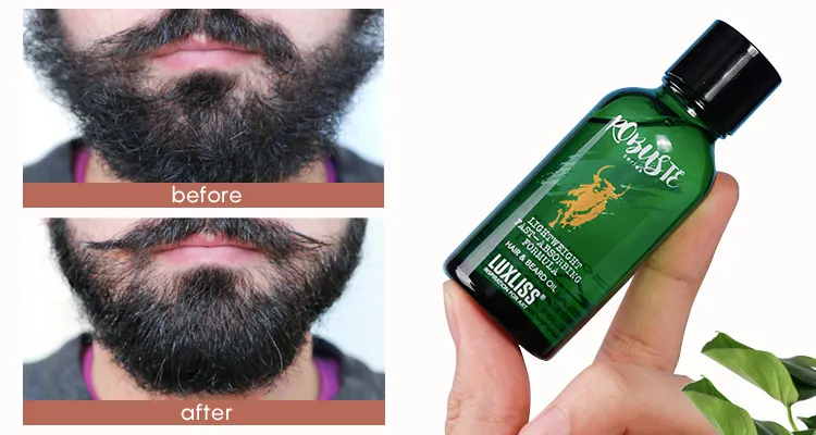 Brand New Top 10 Growth Beard Oil Men With High Quality