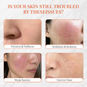 Krim Wajah Ectoin Kelas Medis Bebas Pewangi, Menenangkan Kulit Terbakar Matahari, Melembapkan, Anti-Kerut, Perawatan Setelah Procedur, Kecantikan Estetika - Product Image 3