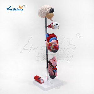 Modèle d'hypertension artérielle : un modèle comparative des vaisseaux sanguins normaux et malades ; un outil pédagogique médical. - Product Image 2