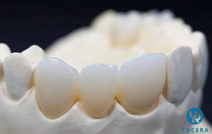 Blocos de Zircônia Multicamadas Yucera <span class=keywords><strong>Dental</strong></span> SHT, Bloco Cerâmico de Zircônia 98mm, Sistema Aberto para CAD/CAM Odontológico - Product Image 4