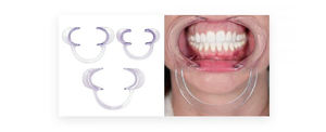 Vendite calde personalizzabili guancia di plastica trasparente riavvolgitore ad alta apertura bocca dentale per ortodontico denti accessori - Product Image 6