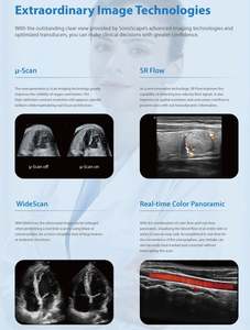 Appareil d'échographie Doppler couleur Sonoscape P11Elite 4D/5D avec fonction IA, chariot, pour les veines, le bébé, l'abdomen - Product Image 3