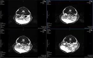 Meilleur prix de la machine de scannage IRM Équipements médicaux IRM - Product Image 3
