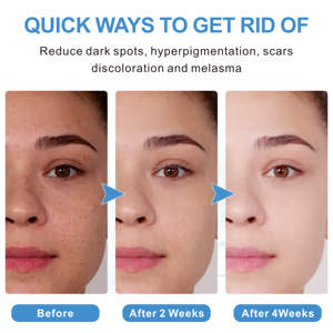 OEM efektif <span class=keywords><strong>Vitamin</strong></span> C suplemen kecantikan sehat l-glutathione kapsul pemutih kulit - Product Image 6