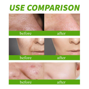 Moisturizing Natural Face <b>Serum</b> Bright <b>Skin</b> <b>Care</b> Whitening Moisturizer Pimples Dark Black Spot Remover - Product Image 5