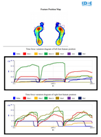 Plateforme de mesure de la pression plantaire pour la conception de semelles orthopédiques pour pieds plats