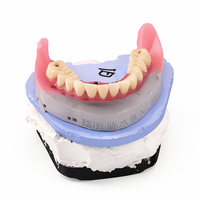 Modèle de prothèse fixe supportée par implant Ecolab Dental Teaching Malong Bridge (alliage cobalt-chrome) pour la formation en prothodontie