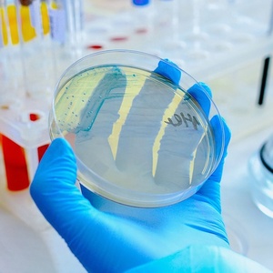 Placas de Petri de Plástico Esterilizadas Personalizadas de 35 mm, 60 mm, 70 mm, 90 mm, 100 mm, 120 mm para Uso en Laboratorios Biológicos - Product Image 1