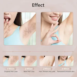 Épilateur IPL domestique avec écran en anglais, appareil portable IPL laser, épilateur permanent - Product Image 2