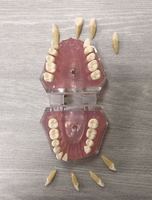 Modèle d'extraction dentaire avec gencive souple et dents amovibles
