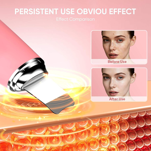 Cepillo de Limpieza Facial Ultrasónico 2 en 1, Exfoliante Facial de Silicona para una Limpieza Profunda, Eliminador de Puntos Negros, Limpiador de Poros - Product Image 4