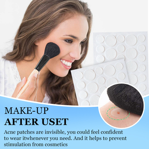 Csx acne36 Hàn Quốc tùy chỉnh Hydrocolloid các bản vá lỗi Vegan salicylic axit mặt chăm sóc nhãn hiệu riêng kháng khuẩn mụn trứng cá mụn - Product Image 5