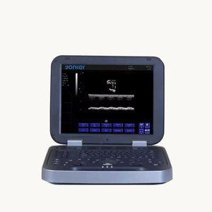 Fitin Fluxo sanguíneo cardíaco e renal médico Máquina portátil do ultrassom da cor doppler do ultrassom do varredor do ultrasonido do portátil - Product Image 3