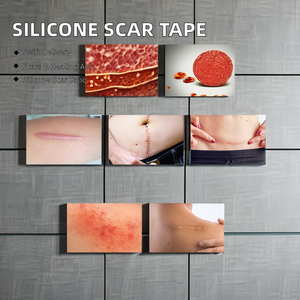Hot Sale 1.6 X 120 Inch 3M Silicone Removal <strong>Tape</strong> Safe for Spa Use Burn Concealing <strong>Scar</strong> <strong>Tape</strong> for Breast Surgery - Product Image 5