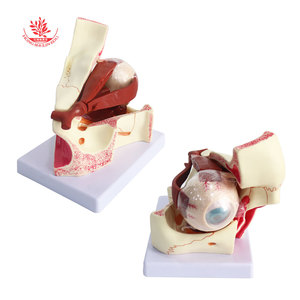 Le modèle anatomique magnifié de l'œil et de l'orbite est trois fois plus grand que l'œil humain, incluant l'optique. - Product Image 3