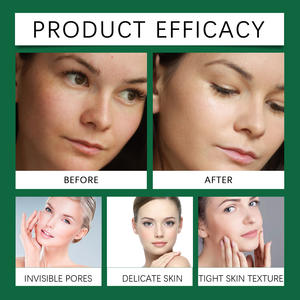 Venta al por mayor de suero salicílico de ácido hialurónico de etiqueta privada cuidado de la piel suero facial reduce los poros Esencia de ácido salicílico orgánico natural - Product Image 3