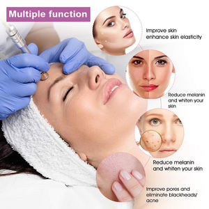 Dermoabrasión 3 en 1 Vacío Punta <span class=keywords><strong>de</strong></span> diamante Microdermoabrasión Máquina Acné Eliminación <span class=keywords><strong>de</strong></span> espinillas Rejuvenecimiento <span class=keywords><strong>DE</strong></span> LA PIEL Spray <span class=keywords><strong>de</strong></span> agua <span class=keywords><strong>Facial</strong></span> - Product Image 3