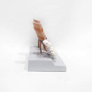 Modelo <span class=keywords><strong>de</strong></span> Comparación <span class=keywords><strong>de</strong></span> Pulmones: Pulmón Saludable vs. Pulmón <span class=keywords><strong>de</strong></span> <span class=keywords><strong>Fumador</strong></span> con Base, Herramienta Educativa para el Control del Tabaco - Product Image 1
