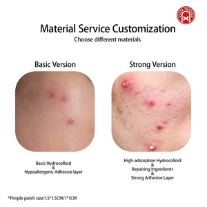 36 Hydrocolloïde Acnepleisters 8mm/12mm Olievrij & Geurvrij voor alle huidtypen, puistjesverwijdering, make-upset - Product Image 3