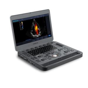 Sonoscape X5V para Mascotas, Ecógrafo Doppler Color Digital Portátil, Ligero, con Pantalla de 15.6 Pulgadas, Precio de Fábrica - Product Image 3