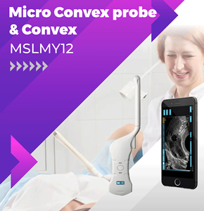 휴대용 초음파 스캐너 기계 전력 소스 플라스틱 초음파 요법 및 젤 워머 - Product Image 3