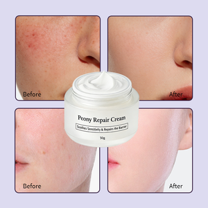 <span class=keywords><strong>Crema</strong></span> <span class=keywords><strong>Viso</strong></span> Riparatrice alla Peonia all'Ingrosso |   <span class=keywords><strong>Crema</strong></span> Lenitiva per Pelle Sensibile, Riparazione della Barriera Cutanea, Anti-Arrossamento, Idratante con Centella Asiatica - Product Image 5