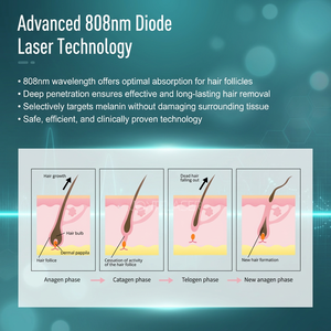 เครื่องกำจัดขนถาวรแบบพกพา รุ่น T4 ความจุ <span class=keywords><strong>200</strong></span> ล้านครั้ง 755/808/1064 กำจัดขนไม่เจ็บปวดด้วยเลเซอร์ไดโอด 808 นาโนเมตร - Product Image 4