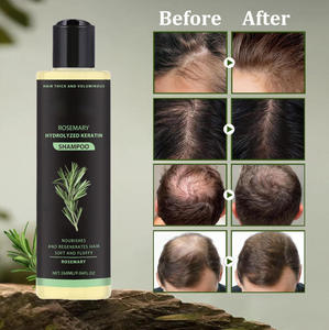 Champú Orgánico de Romero con Queratina para el <span class=keywords><strong>Crecimiento</strong></span> del <span class=keywords><strong>Cabello</strong></span>, Anti-Caída y Suavizante, para el Mercado de Oriente Medio - Product Image 3