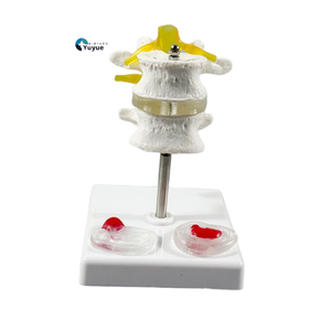 Mô hình giảng dạy y tế, cột sống thắt lưng & mô hình đĩa đệm cho bệnh lý cột sống của con người & Giải Thích bác sĩ-Bệnh nhân - Product Image 1