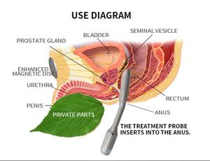 Máquina de massagem da próstata, alta qualidade ferramentas com estimulador de próstata de choque elétrico - Product Image 5