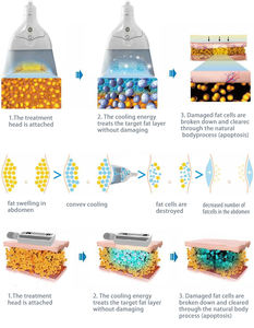 เครื่องแช่แข็งสลายไขมัน กำจัดเซลลูไลท์ สำหรับร้านเสริมสวย ปี 2026 - Product Image 3