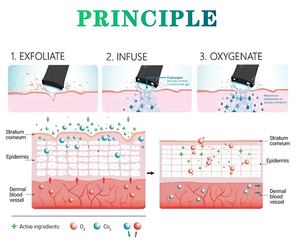 Macchina Portatile per Ossigenoterapia CO2 per Uso Domestico, Pulizia del Viso e Cura della Pelle, Attrezzatura di Bellezza Sicura - Product Image 2