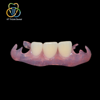 Prothèse dentaire partielle amovible en nylon thermoplastique flexible de haute qualité, prothèse dentaire personnalisée
