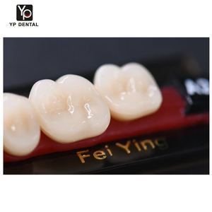 Dents en résine acrylique synthétique supérieures et inférieures, antérieures et postérieures, pour prothèses dentaires flexibles et fixes, manuelles - Product Image 5