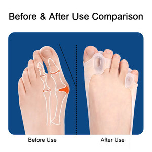 Séparateur d'orteils à double trou avec bande de résistance élastique pour <span class=keywords><strong>Hallux</strong></span> <span class=keywords><strong>Valgus</strong></span> - Product Image 5