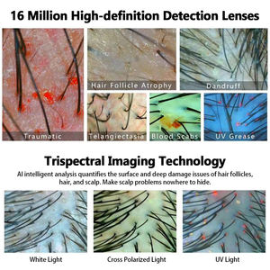 Miroir capillaire médical intelligent à IA, analyseur de cuir chevelu, traitement anti-chute de cheveux, détection des follicules capillaires, machine d'analyse du cuir chevelu - Product Image 4