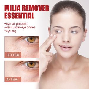 Sérum pour les yeux South Moon 30 ml, logo personnalisé, élimination des particules graisseuses et des poches sous les yeux en 1 semaine, éliminateur de <span class=keywords><strong>milia</strong></span> lunaire, essentiel - Product Image 2