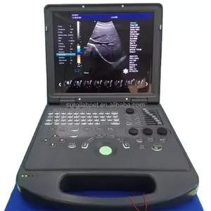 초음파 기계 초음파 광학 전자 장비 L4 초음파 기계 휴대용 4D 도플러 가격 의료 초음파