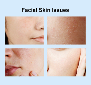 Crème hydratante pour le visage à <span class=keywords><strong>prix</strong></span> de gros, <span class=keywords><strong>formule</strong></span> non grasse à absorption rapide pour peaux grasses et sensibles - Product Image 3