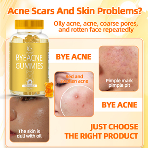 高品質ハーバルサプリメント大人のためのにきびと戦うミイラ肌クレンジング赤み除去 - Product Image 2